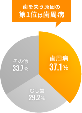 歯が抜ける多くの原因が“歯周病”