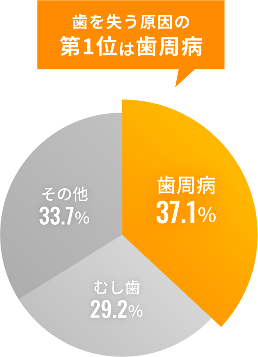 歯が抜ける多くの原因が“歯周病”